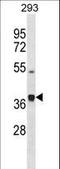 Procollagen C-Endopeptidase Enhancer 2 antibody, LS-C158034, Lifespan Biosciences, Western Blot image 