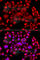 Phosphatidylinositol-5-Phosphate 4-Kinase Type 2 Beta antibody, A8016, ABclonal Technology, Immunofluorescence image 