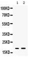 Peptide YY antibody, PA5-79900, Invitrogen Antibodies, Western Blot image 