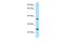 D-Aminoacyl-TRNA Deacylase 1 antibody, NBP2-35325, Novus Biologicals, Western Blot image 