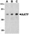 Apoptosis Antagonizing Transcription Factor antibody, MBS150631, MyBioSource, Western Blot image 