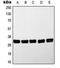 MYD88 Innate Immune Signal Transduction Adaptor antibody, orb214286, Biorbyt, Western Blot image 
