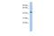 Programmed Cell Death 7 antibody, A14830, Boster Biological Technology, Western Blot image 