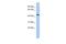 Programmed Cell Death 7 antibody, A14830, Boster Biological Technology, Western Blot image 