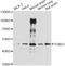 Tubulin Gamma 1 antibody, LS-C749552, Lifespan Biosciences, Western Blot image 