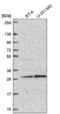 Yip1 Interacting Factor Homolog B, Membrane Trafficking Protein antibody, NBP2-57630, Novus Biologicals, Western Blot image 