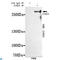 Chromodomain Helicase DNA Binding Protein 3 antibody, LS-C812915, Lifespan Biosciences, Immunoprecipitation image 