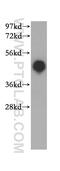 Major Histocompatibility Complex, Class I-Related antibody, 15240-1-AP, Proteintech Group, Western Blot image 