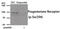 Progesterone Receptor antibody, 80-039, ProSci, Western Blot image 