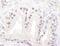ATM Serine/Threonine Kinase antibody, NB100-678, Novus Biologicals, Immunohistochemistry frozen image 