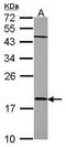 Phospholipase A And Acyltransferase 4 antibody, GTX114706, GeneTex, Western Blot image 