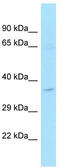 Mitochondrial Ribosomal Protein L9 antibody, TA331700, Origene, Western Blot image 