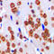 Integrin Subunit Alpha V antibody, LS-C352390, Lifespan Biosciences, Immunohistochemistry frozen image 