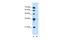 Solute Carrier Family 17 Member 3 antibody, A08201, Boster Biological Technology, Western Blot image 