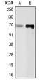 Chromogranin A antibody, LS-B16074, Lifespan Biosciences, Western Blot image 