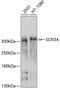 Sodium Voltage-Gated Channel Alpha Subunit 3 antibody, 13-412, ProSci, Western Blot image 