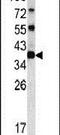 Chloride Nucleotide-Sensitive Channel 1A antibody, PA5-13449, Invitrogen Antibodies, Western Blot image 