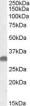 OTU Deubiquitinase, Ubiquitin Aldehyde Binding 1 antibody, TA305680, Origene, Western Blot image 