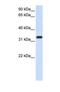 Store-Operated Calcium Entry Associated Regulatory Factor antibody, NBP1-69489, Novus Biologicals, Western Blot image 