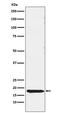 Thyroid Stimulating Hormone Subunit Beta antibody, M04304, Boster Biological Technology, Western Blot image 