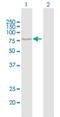 Arachidonate 12-Lipoxygenase, 12S Type antibody, H00000239-B01P, Novus Biologicals, Western Blot image 