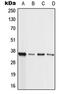 Lysine Methyltransferase 2B antibody, GTX55187, GeneTex, Western Blot image 