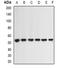 Cellular Communication Network Factor 2 antibody, orb378015, Biorbyt, Western Blot image 