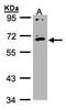Interleukin 17 Receptor C antibody, PA5-21663, Invitrogen Antibodies, Western Blot image 