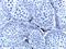 Cytochrome P450 Family 17 Subfamily A Member 1 antibody, NBP2-01151, Novus Biologicals, Immunohistochemistry paraffin image 