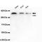 Cyclin Dependent Kinase 5 antibody, M00511-1, Boster Biological Technology, Western Blot image 