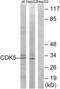 Cyclin Dependent Kinase 5 antibody, abx012839, Abbexa, Western Blot image 