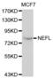 Neurofilament Light antibody, abx000642, Abbexa, Western Blot image 