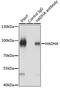Hydroxyacyl-CoA Dehydrogenase Trifunctional Multienzyme Complex Subunit Alpha antibody, GTX32642, GeneTex, Immunoprecipitation image 