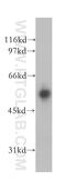 Inosine Monophosphate Dehydrogenase 2 antibody, 12948-1-AP, Proteintech Group, Western Blot image 