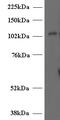 5-hydroxytryptamine receptor 3A antibody, 46-357, ProSci, Western Blot image 