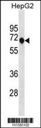 Ankyrin Repeat And Death Domain Containing 1A antibody, 60-686, ProSci, Western Blot image 