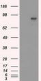 SATB Homeobox 1 antibody, LS-C797088, Lifespan Biosciences, Western Blot image 