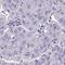 Zinc Finger SWIM-Type Containing 3 antibody, HPA055692, Atlas Antibodies, Immunohistochemistry paraffin image 