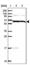 ALG8 Alpha-1,3-Glucosyltransferase antibody, PA5-62512, Invitrogen Antibodies, Western Blot image 