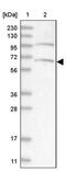 Armadillo Repeat Containing 8 antibody, PA5-57907, Invitrogen Antibodies, Western Blot image 