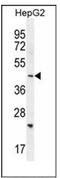 SH2 Domain Containing 4B antibody, AP53898PU-N, Origene, Western Blot image 