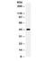 Wnt Family Member 2B antibody, R32298, NSJ Bioreagents, Western Blot image 