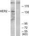 ERBB2 antibody, LS-C119532, Lifespan Biosciences, Western Blot image 