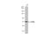 Sterile Alpha And TIR Motif Containing 1 antibody, GTX131411, GeneTex, Western Blot image 