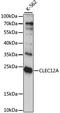 C-Type Lectin Domain Family 12 Member A antibody, A6250, ABclonal Technology, Western Blot image 