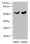 Solute Carrier Family 25 Member 25 antibody, CSB-PA760850LA01HU, Cusabio, Western Blot image 