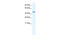 Annexin A7 antibody, 28-519, ProSci, Western Blot image 