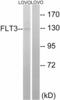 Fms Related Tyrosine Kinase 3 antibody, A00188-1, Boster Biological Technology, Western Blot image 