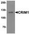Cysteine Rich Transmembrane BMP Regulator 1 antibody, TA319055, Origene, Western Blot image 