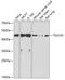 Tumor Susceptibility 101 antibody, 16-799, ProSci, Western Blot image 